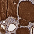 Immunohistochemical staining of human thyroid gland shows strong positivity in plasma.