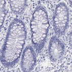 Immunohistochemical staining of human rectum shows no positivity in glandular cells as expected.