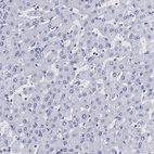 Immunohistochemical staining of human liver shows no positivity in hepatocytes as expected.