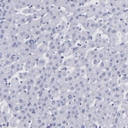 Immunohistochemical staining of human liver shows no positivity in hepatocytes as expected.