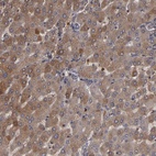 Anti-SERPINA7 Antibody