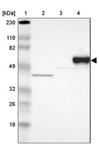 Lane 1: Marker [kDa] 230, 110, 82, 49, 32, 26, 18_br/_Lane 2: Human cell line RT-4_br/_Lane 3: Human cell line U-251MG sp_br/_Lane 4: Human plasma (IgG/HSA depleted)
