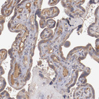 Anti-CXorf36 Antibody