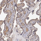 Anti-CXorf36 Antibody