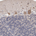 Anti-CXorf36 Antibody