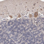 Immunohistochemical staining of human cerebellum shows moderate cytoplasmic positivity in Purkinje cells.