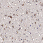 Immunohistochemical staining of human cerebral cortex shows moderate cytoplasmic positivity in neurons.