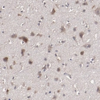 Immunohistochemical staining of human cerebral cortex shows moderate cytoplasmic positivity in neurons.