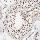 Immunohistochemical staining of human testis shows strong nuclear positivity in cells in seminiferous ducts.