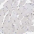 Immunohistochemical staining of human skeletal muscle shows strong nuclear positivity in myocytes.