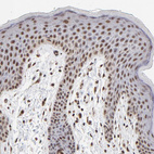 Immunohistochemical staining of human skin shows strong nuclear positivity in squamous epithelial cells.