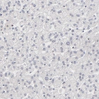 Immunohistochemical staining of human liver shows no positivity in hepatocytes as expected.