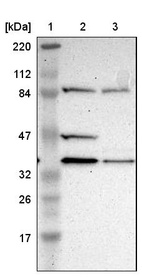 Lane 1: Marker [kDa] 220, 112, 84, 47, 32, 26, 17_br/_Lane 2: Human cell line RT-4_br/_Lane 3: Human cell line U-251MG sp