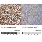 Anti-UQCRC1 Antibody