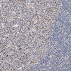 Immunohistochemical staining of human lymph node shows low expression as expected.