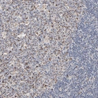 Immunohistochemical staining of human lymph node shows low expression as expected.
