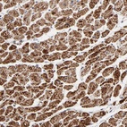 Anti-UQCRC1 Antibody