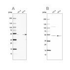 Western blot analysis using Anti-UQCRC1 antibody HPA002815 (A) shows similar pattern to independent antibody HPA003525 (B).
