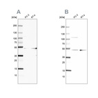 Anti-UQCRC1 Antibody