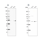 Western blot analysis using Anti-UQCRC1 antibody HPA002815 (A) shows similar pattern to independent antibody HPA003525 (B).