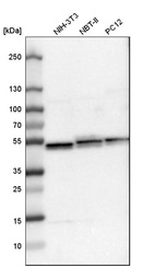 Anti-UQCRC1 Antibody