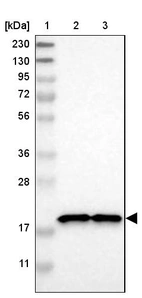 Lane 1: Marker [kDa] 230, 130, 95, 72, 56, 36, 28, 17, 11_br/_Lane 2: Human cell line RT-4_br/_Lane 3: Human cell line U-251MG sp