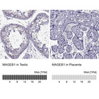 Anti-MAGEB1 Antibody