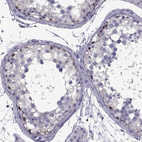 Anti-MAGEB1 Antibody