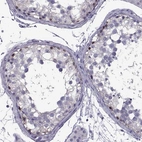 Immunohistochemical staining of human testis shows moderate nuclear positivity in cells in seminiferous ducts.