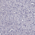 Immunohistochemical staining of human liver shows no positivity in hepatocytes as expected.