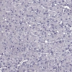 Immunohistochemical staining of human liver shows no positivity in hepatocytes as expected.