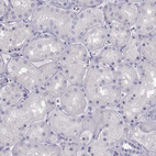 Anti-MAGEB1 Antibody