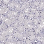 Immunohistochemical staining of human kidney shows no positivity in cells in tubules as expected.