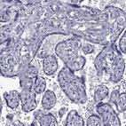 Immunohistochemical staining of human placenta shows no positivity in trophoblastic cells as expected.