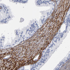 Anti-EMILIN1 Antibody