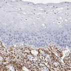 Immunohistochemical staining of human skin shows strong positivity in connective tissue.