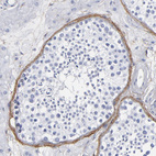 Immunohistochemical staining of human testis shows moderate membranous positivity in peritubular myoid cells.