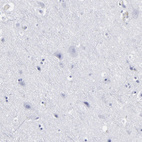 Anti-EMILIN1 Antibody