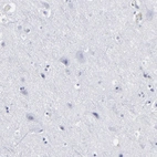 Immunohistochemical staining of human cerebral cortex shows no positivity in neurons as expected.