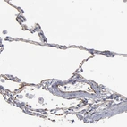 Immunohistochemical staining of human Lung shows moderate membranous positivity in pneumocytes.