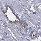 Immunohistochemical staining of human Breast shows moderate membranous positivity in glandular cells.
