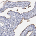 Immunohistochemical staining of human Fallopian tube shows moderate membranous positivity in glandular cells.