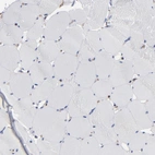 Immunohistochemical staining of human Skeletal muscle shows very weak membranous positivity in myocytes.