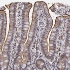 Anti-SLC15A1 Antibody