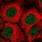 Immunofluorescent staining of human cell line CACO-2 shows localization to nucleoplasm.