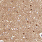 Anti-TXNL1 Antibody