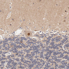 Anti-TXNL1 Antibody