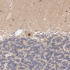 Immunohistochemical staining of human cerebellum shows strong nuclear positivity in Purkinje cells.