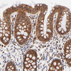 Anti-TXNL1 Antibody