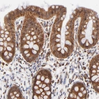 Immunohistochemical staining of human colon shows strong cytoplasmic and membranous positivity in glandular cells.